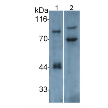 Integrin Beta 6 (ITGb6) Human Polyclonal Antibody
