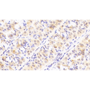 Integrin Beta 8 (ITGb8) Human Polyclonal Antibody