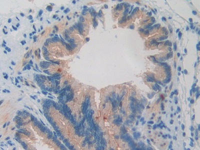 Bone Morphogenetic Protein 15 (BMP15) Rat Polyclonal Antibody