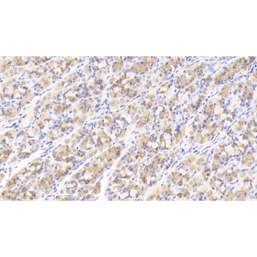 Growth Differentiation Factor 5 (GDF5) Human Polyclonal Antibody