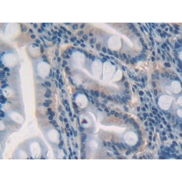 Growth Differentiation Factor 5 (GDF5) Human Polyclonal Antibody