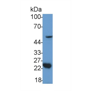 Growth Differentiation Factor 11 (GDF11) Human Polyclonal Antibody