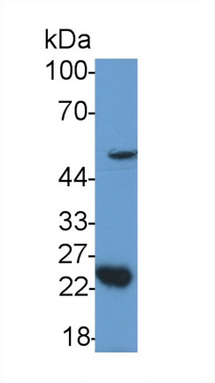 Growth Differentiation Factor 11 (GDF11) Human Polyclonal Antibody