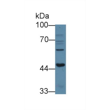 Activin A Receptor Type I B (ACVR1B) Human Polyclonal Antibody