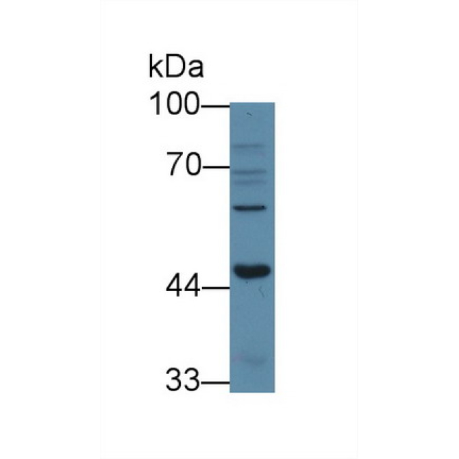 Activin A Receptor Type I B (ACVR1B) Human Polyclonal Antibody