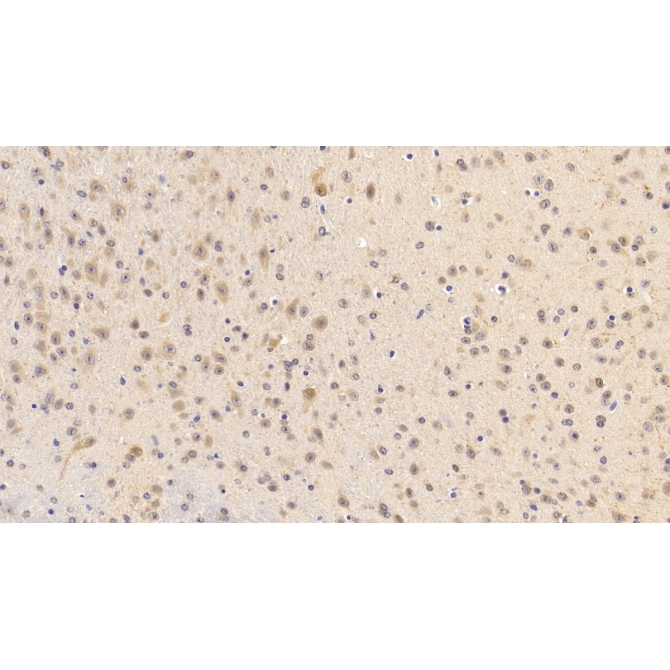 Activin A Receptor Type I B (ACVR1B) Mouse Polyclonal Antibody