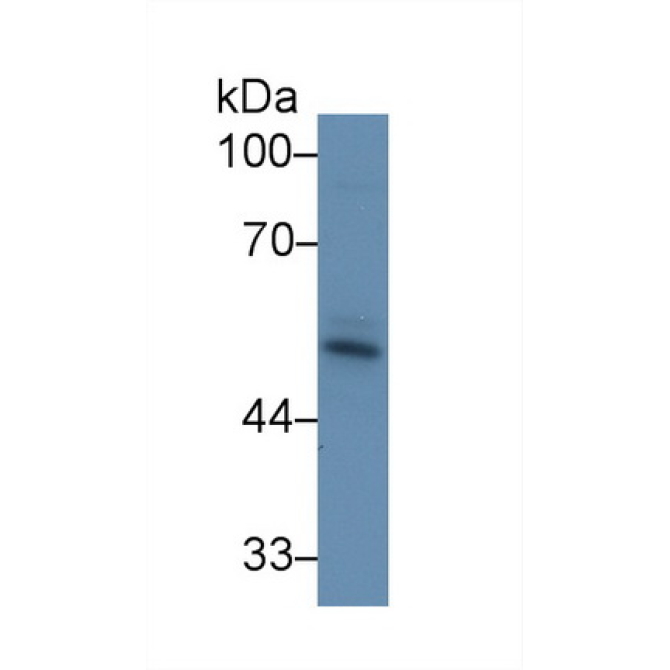 Activin A Receptor Type II A (ACVR2A) Bovine (Cattle) Polyclonal Antibody