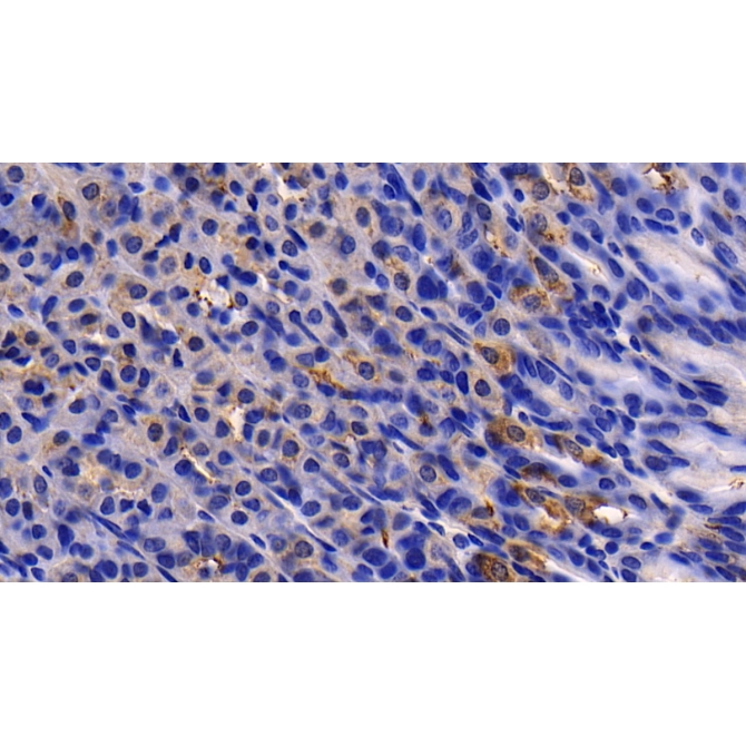 Activin A Receptor Type II A (ACVR2A) Mouse Polyclonal Antibody