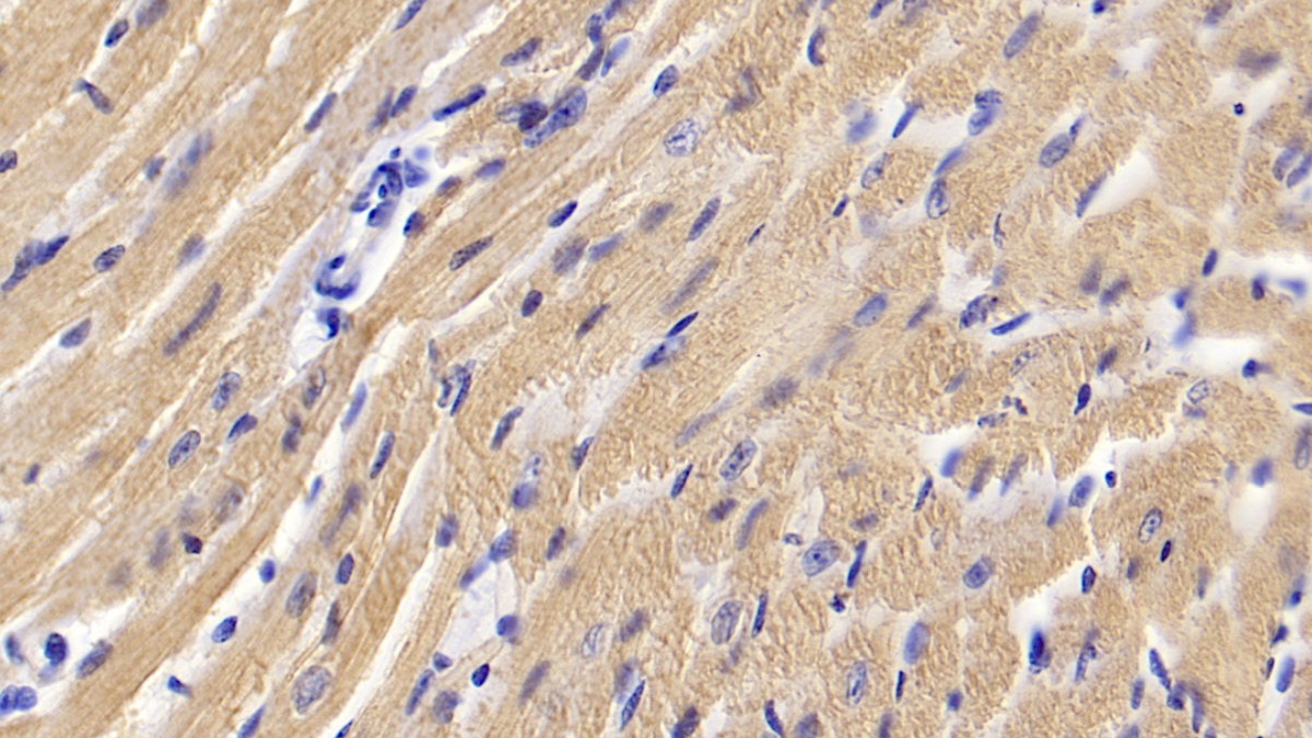 Activin A Receptor Type II A (ACVR2A) Mouse Polyclonal Antibody