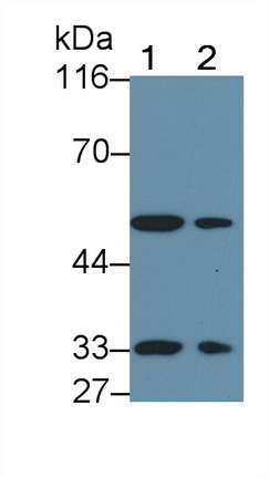Activin A Receptor Type II B (ACVR2B) Mouse Polyclonal Antibody