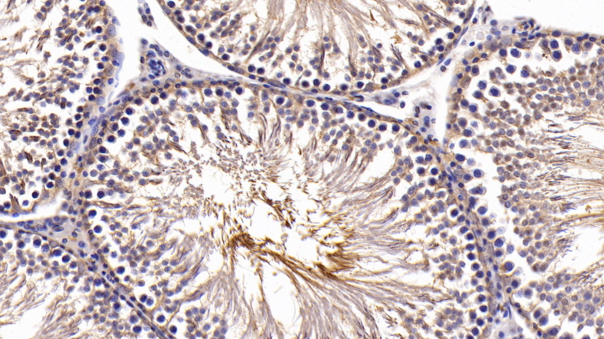 Activin A Receptor Type II B (ACVR2B) Rat Polyclonal Antibody