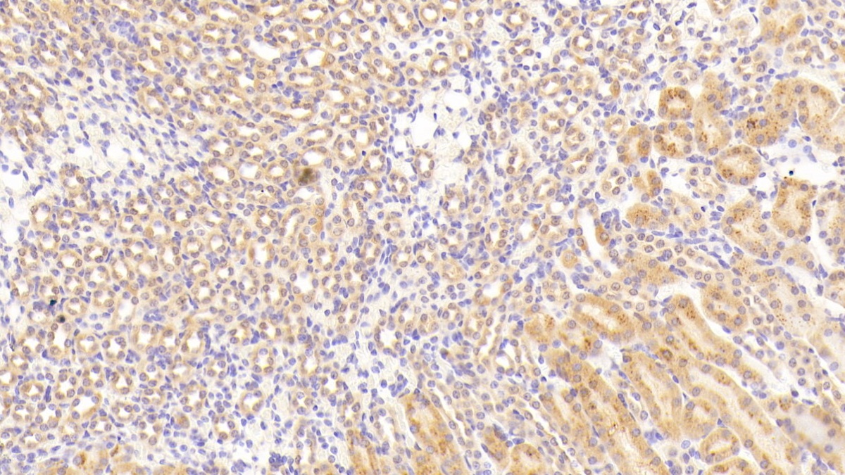 Transforming Growth Factor Beta Receptor III (TGFbR3) Mouse Polyclonal Antibody