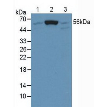 SMAD family member 5 (SMAD5) Human Polyclonal Antibody