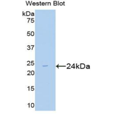 Mothers Against Decapentaplegic Homolog 2 (Smad2) Mouse Polyclonal Antibody