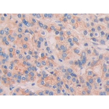 Chordin (CHRD) Human Polyclonal Antibody