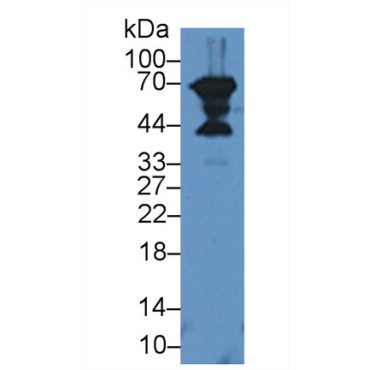 Decorin (DCN) Human Polyclonal Antibody