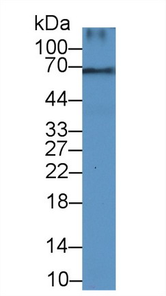 Decorin (DCN) Human Polyclonal Antibody