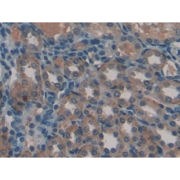 Gremlin 1 (GREM1) Human Polyclonal Antibody
