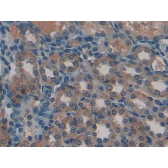 Gremlin 1 (GREM1) Human Polyclonal Antibody