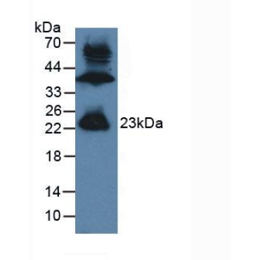 Gremlin 1 (GREM1) Human Polyclonal Antibody