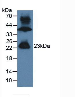 Gremlin 1 (GREM1) Human Polyclonal Antibody