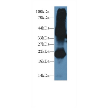 Gremlin 1 (GREM1) Mouse Polyclonal Antibody