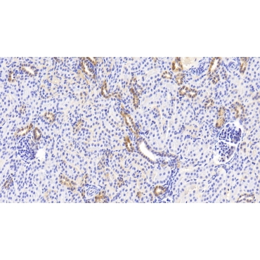 Noggin (NOG) Human Polyclonal Antibody