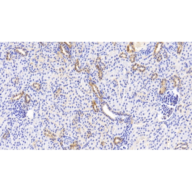 Noggin (NOG) Human Polyclonal Antibody