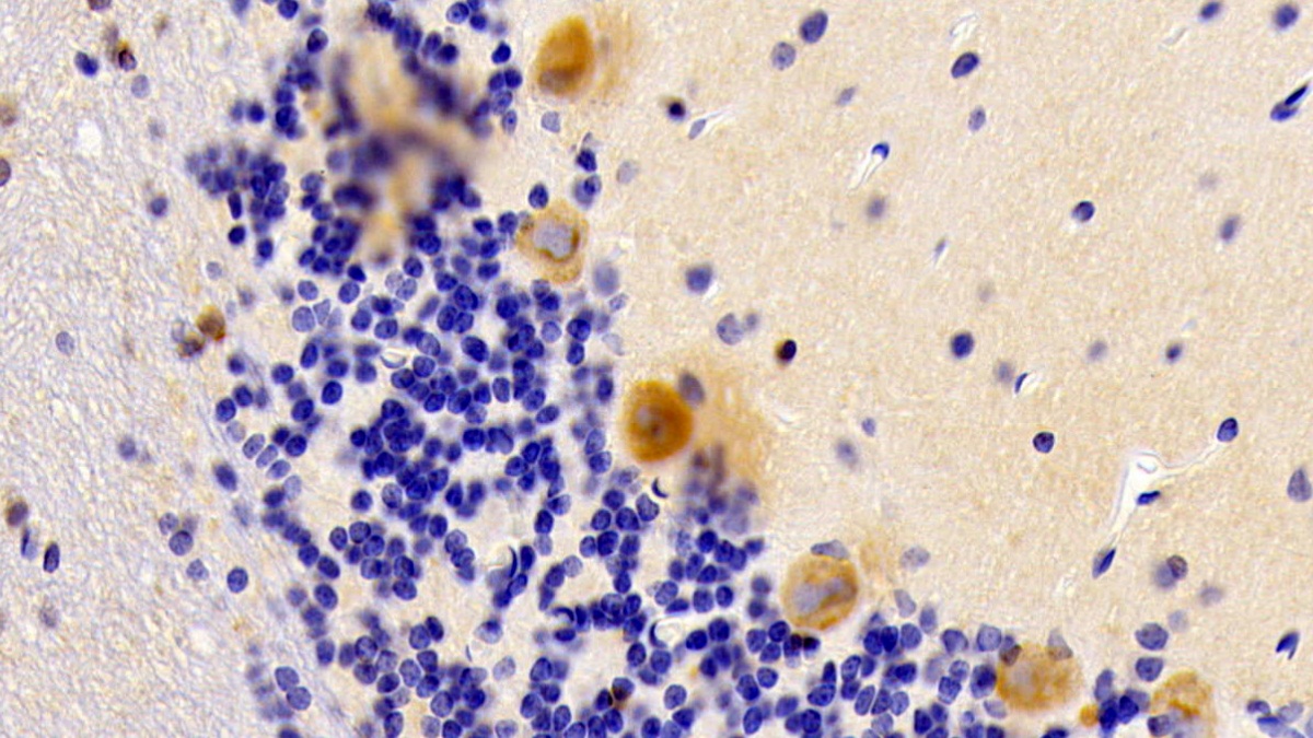 Noggin (NOG) Rat Polyclonal Antibody