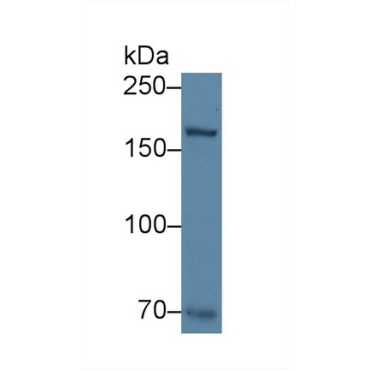 Collagen Type XVII (COL17) Human Polyclonal Antibody