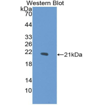 Collagen Type XV (COL15) Human Polyclonal Antibody