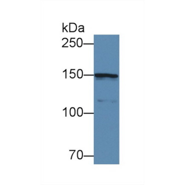 Collagen Type IV Alpha 5 (COL4a5) Human Polyclonal Antibody