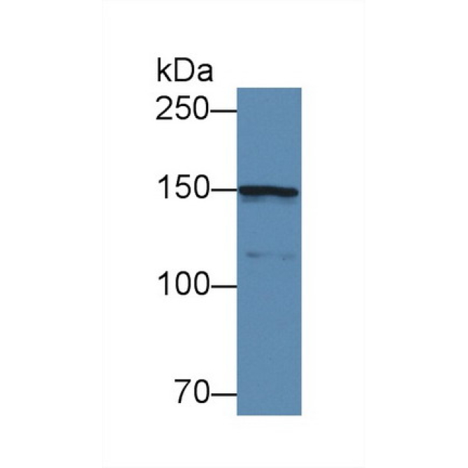 Collagen Type IV Alpha 5 (COL4a5) Human Polyclonal Antibody