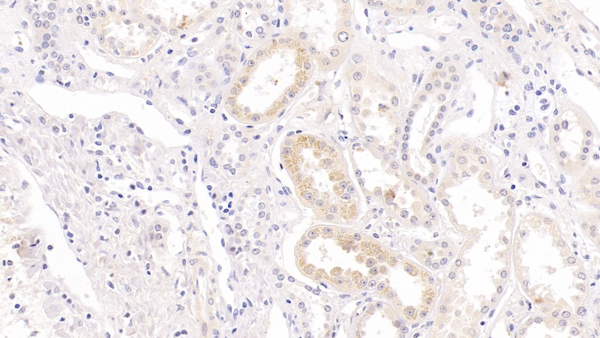 Collagen Type IV Alpha 4 (COL4a4) Pan-species (General) Polyclonal Antibody