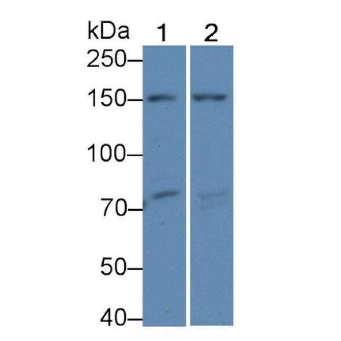 Collagen Type IV Alpha 4 (COL4a4) Human Polyclonal Antibody