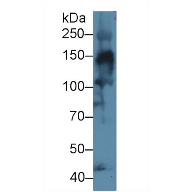 Collagen Type IV Alpha 3 (COL4a3) Human Polyclonal Antibody