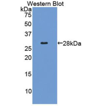 Collagen Type IV Alpha 2 (COL4a2) Human Polyclonal Antibody