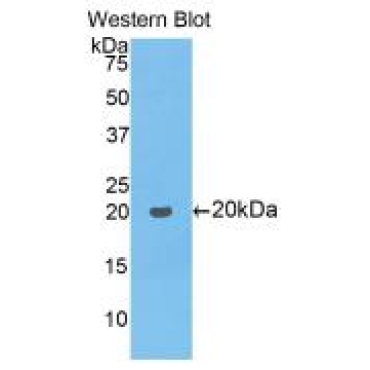Collagen Type VIII Alpha 1 (COL8a1) Mouse Polyclonal Antibody