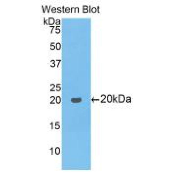 Collagen Type VIII Alpha 1 (COL8a1) Mouse Polyclonal Antibody