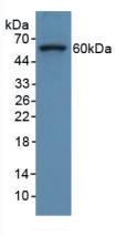 Collagen Type VIII Alpha 1 (COL8a1) Rat Polyclonal Antibody