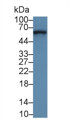 Collagen Type VIII Alpha 1 (COL8a1) Rabbit Polyclonal Antibody