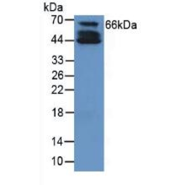 Collagen Type X (COL10) Human Polyclonal Antibody