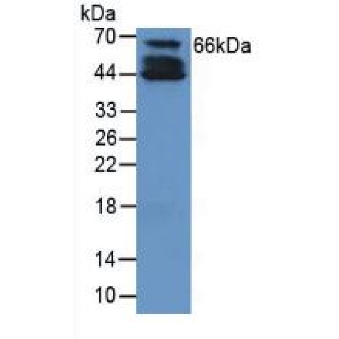 Collagen Type X (COL10) Human Polyclonal Antibody