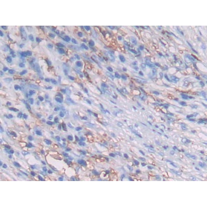 HLA Class II Histocompatibility Antigen, DRB1 Beta Chain (HLA-DRB1) Human Polyclonal Antibody