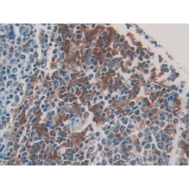 HLA Class II Histocompatibility Antigen, DRB1 Beta Chain (HLA-DRB1) Mouse Polyclonal Antibody