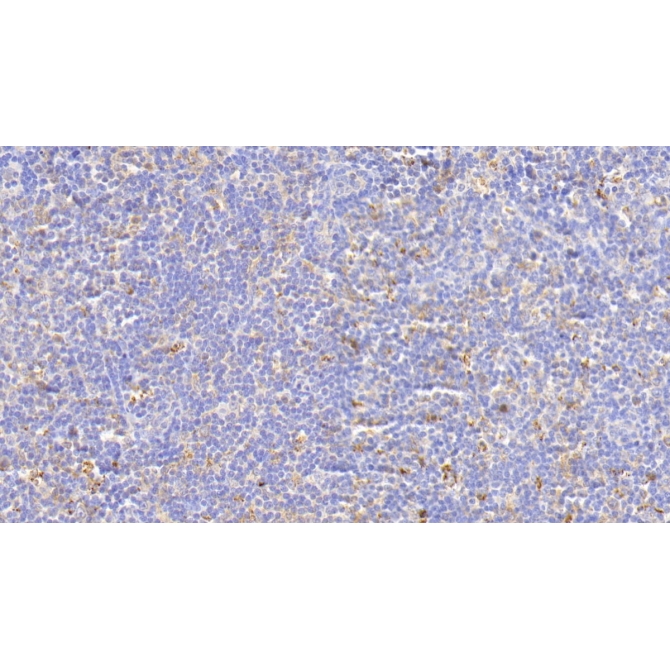 Glial Cell Line Derived Neurotrophic Factor Receptor Alpha 2 (GFRa2) Human Polyclonal Antibody