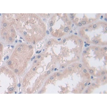 Persephin (PSPN) Human Polyclonal Antibody