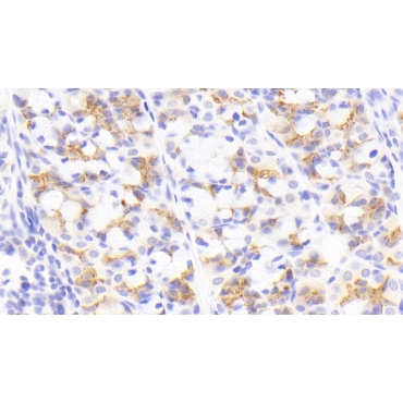 Neuregulin 4 (NRG4) Human Polyclonal Antibody