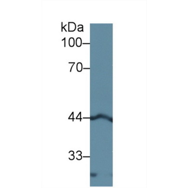 Left/Right Determination Factor 1 (LEFTY1) Human Polyclonal Antibody