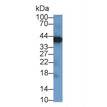 Left/Right Determination Factor 1 (LEFTY1) Human Polyclonal Antibody